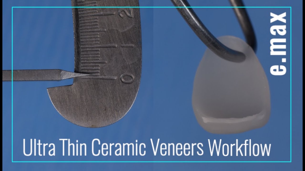 Finishing Thin Prepless Ceramic Veneers