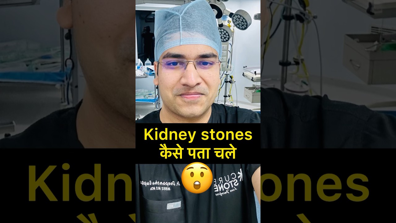 What are the symptoms of kidney stone | Rirs | Treatment of kidney stone | trending | Viral
