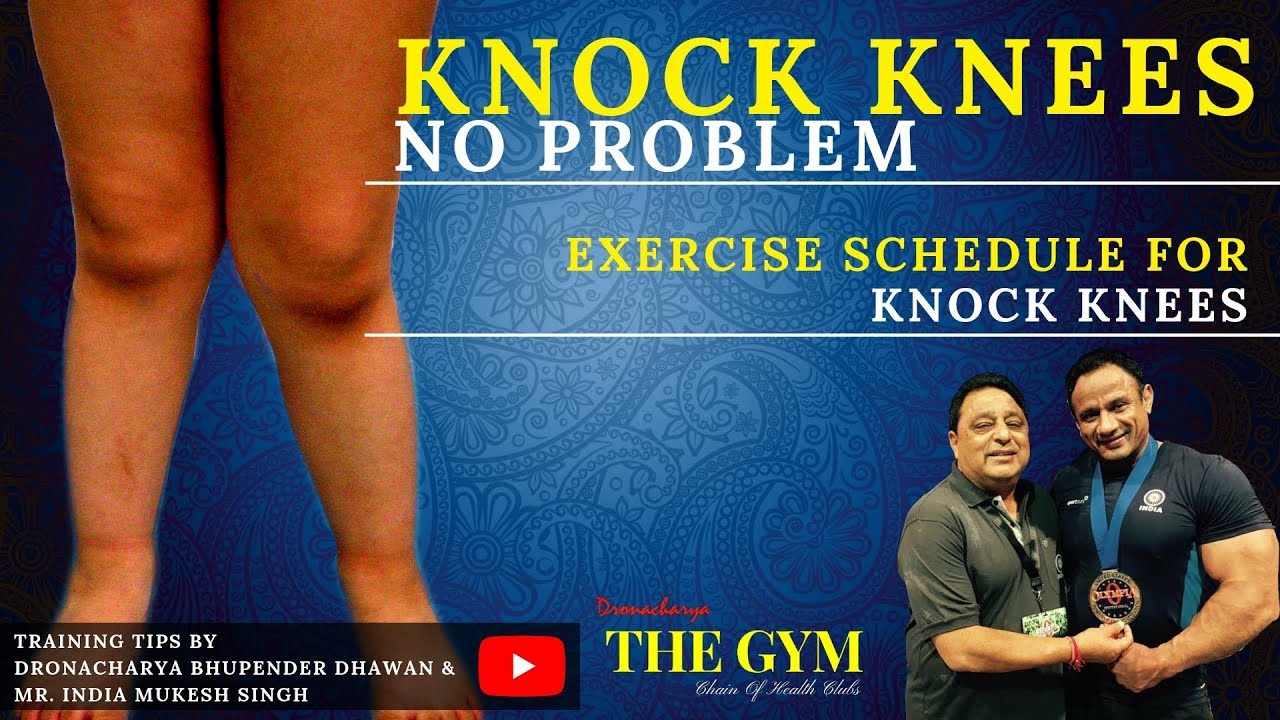 Knock Knees, No Problem | Exercise Schedule For Knock Knees