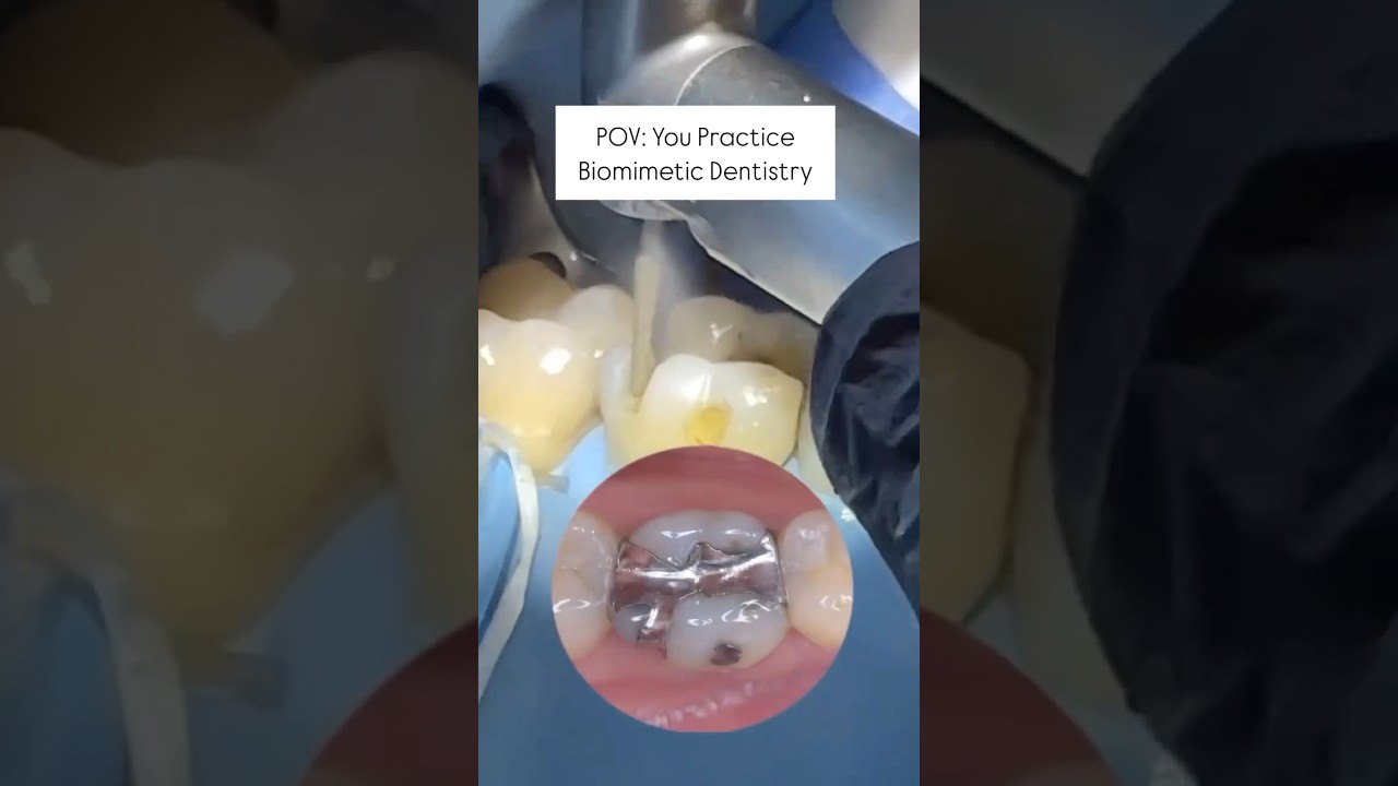 Biomimetic Dentistry #biomimeticdentistry #restorativedentistry #dentist