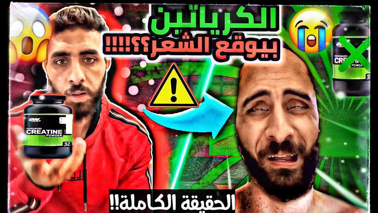 مكمل الكرياتين بيوقع الشعر و بيسبب الصلع 😳الحقيقة الكاملة