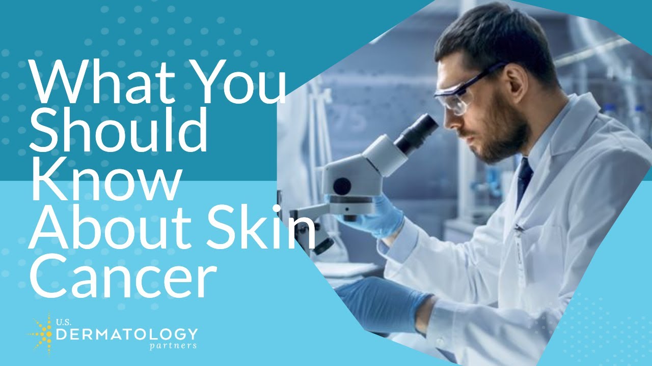What You Should Know About Skin Cancer