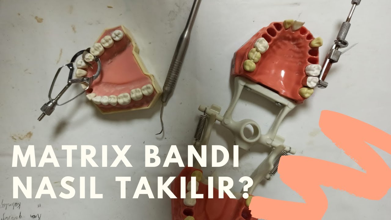 Matrix Bandı Nasıl Takılır? Kama Nasıl Takılır? (Halka-Düz-Tofflemire Matrix)/(Yengeç-İvory Matrix)
