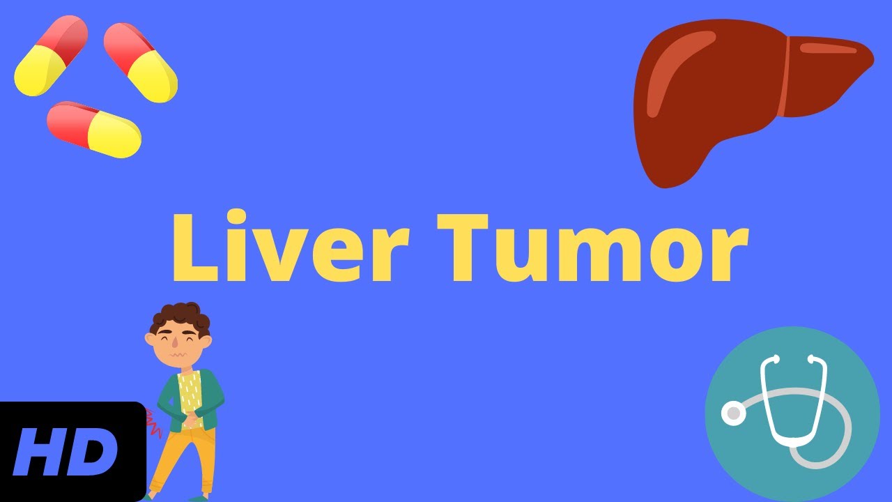 Liver Tumor, Causes, Signs and Symptoms, Diagnosis and Treatment.