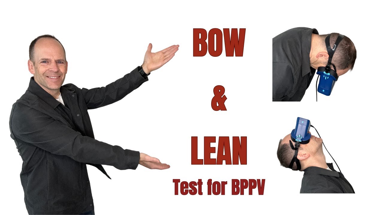 Bow and Lean Test for BPPV: How & When to Perform