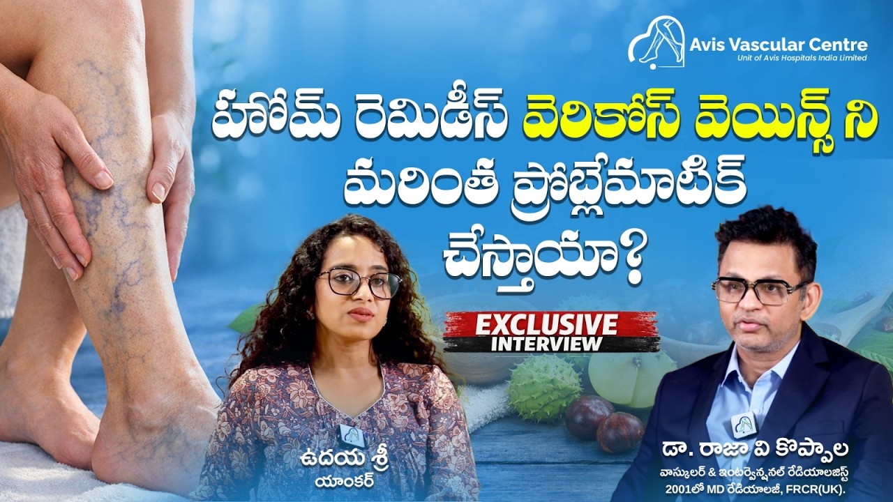 Varicose Veins: Myths, Recurrence & Modern Treatment | Dr. Rajah V Koppala | Avis Hospitals