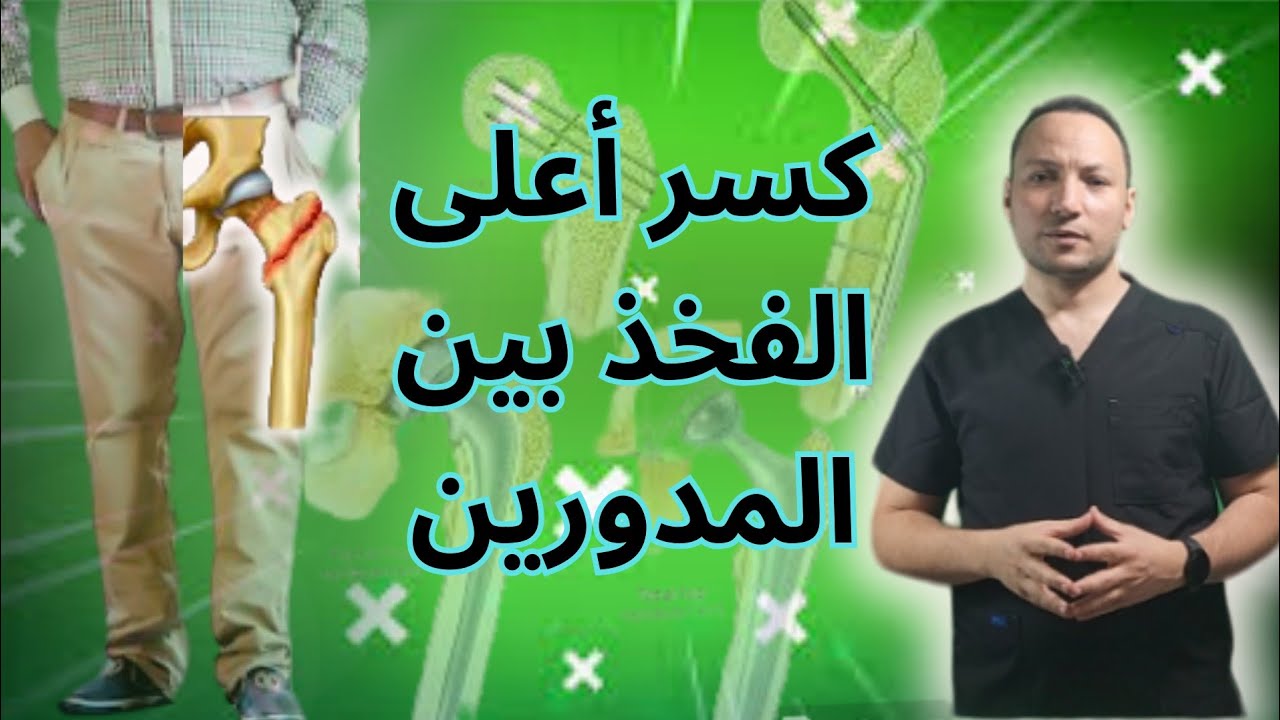 كسر أعلى عظمة الفخذ _بين المدورين