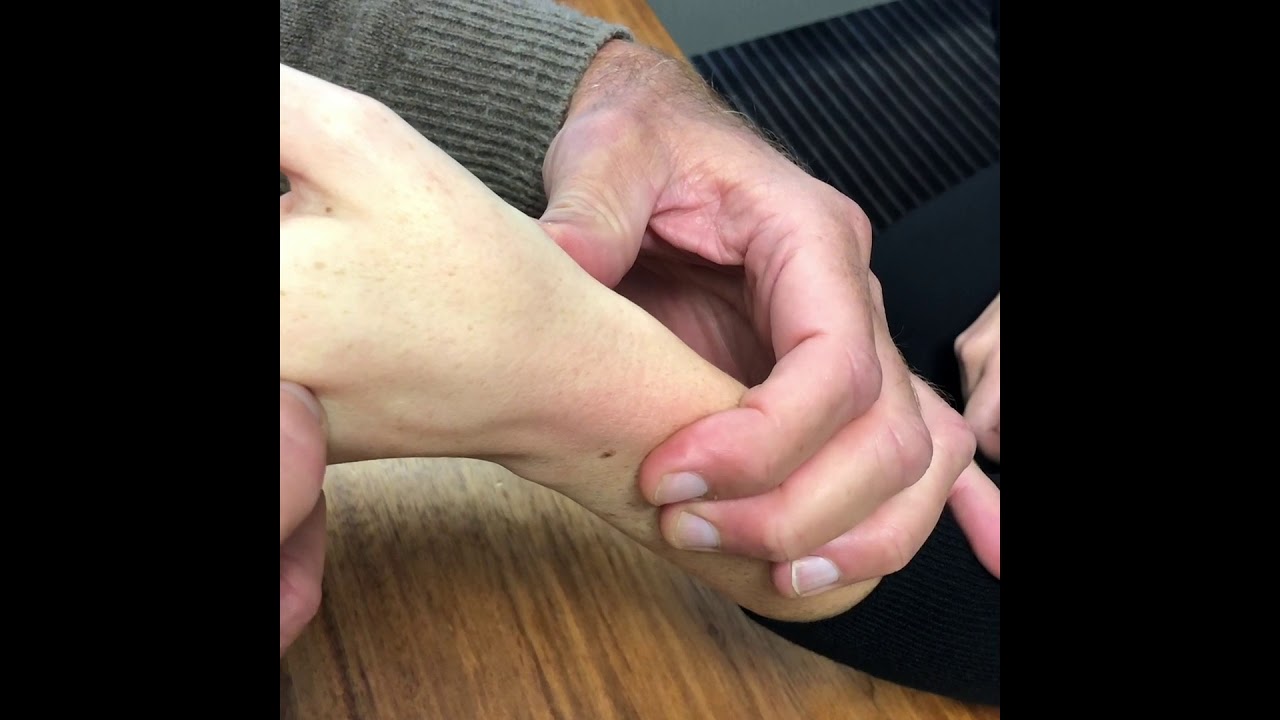 Синдром дорсальной части запястья и инъекция