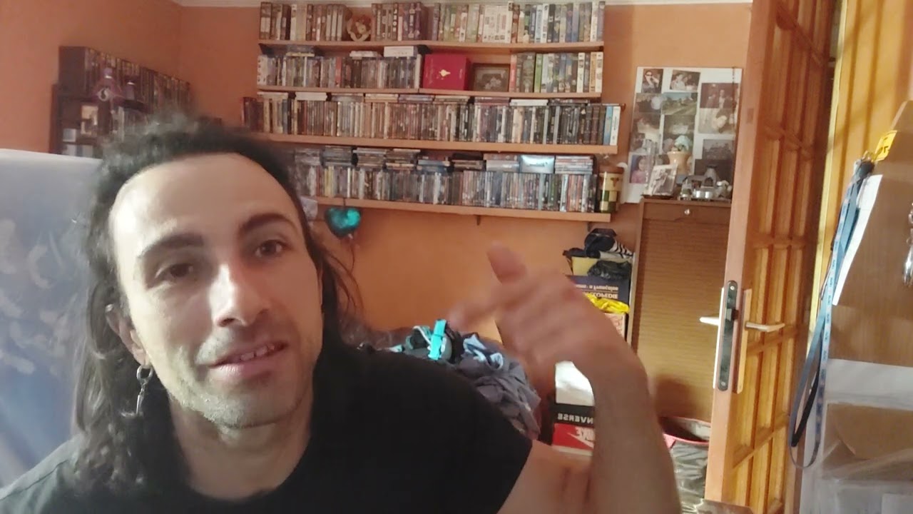 GREFFE CAPILLAIRE TURQUIE KLINEVA EP 8 +12 MOIS 1 an le bilan