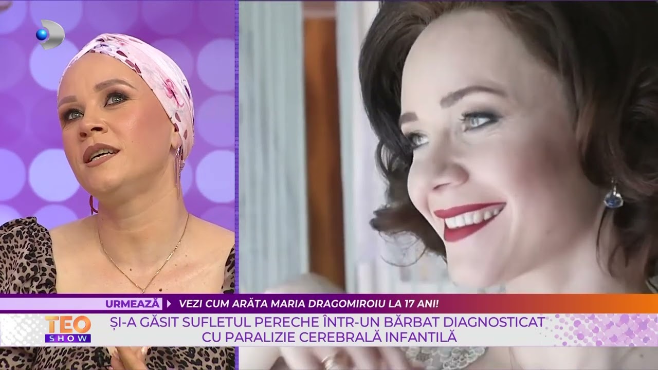 Teo Show (23.05.2022) - Ala Milescu, diagnosticata cu alopecie, de 10 ani!