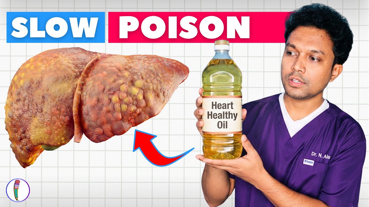 &laquo;Полезное для сердца&raquo; масло? Ложь, которая разрушает вашу печень! 🛑 | Жировая дистрофия печени