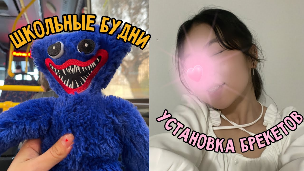 ВЛОГ//ШКОЛЬНЫЕ БУДНИ//СТАВЛЮ БРЕКЕТЫ