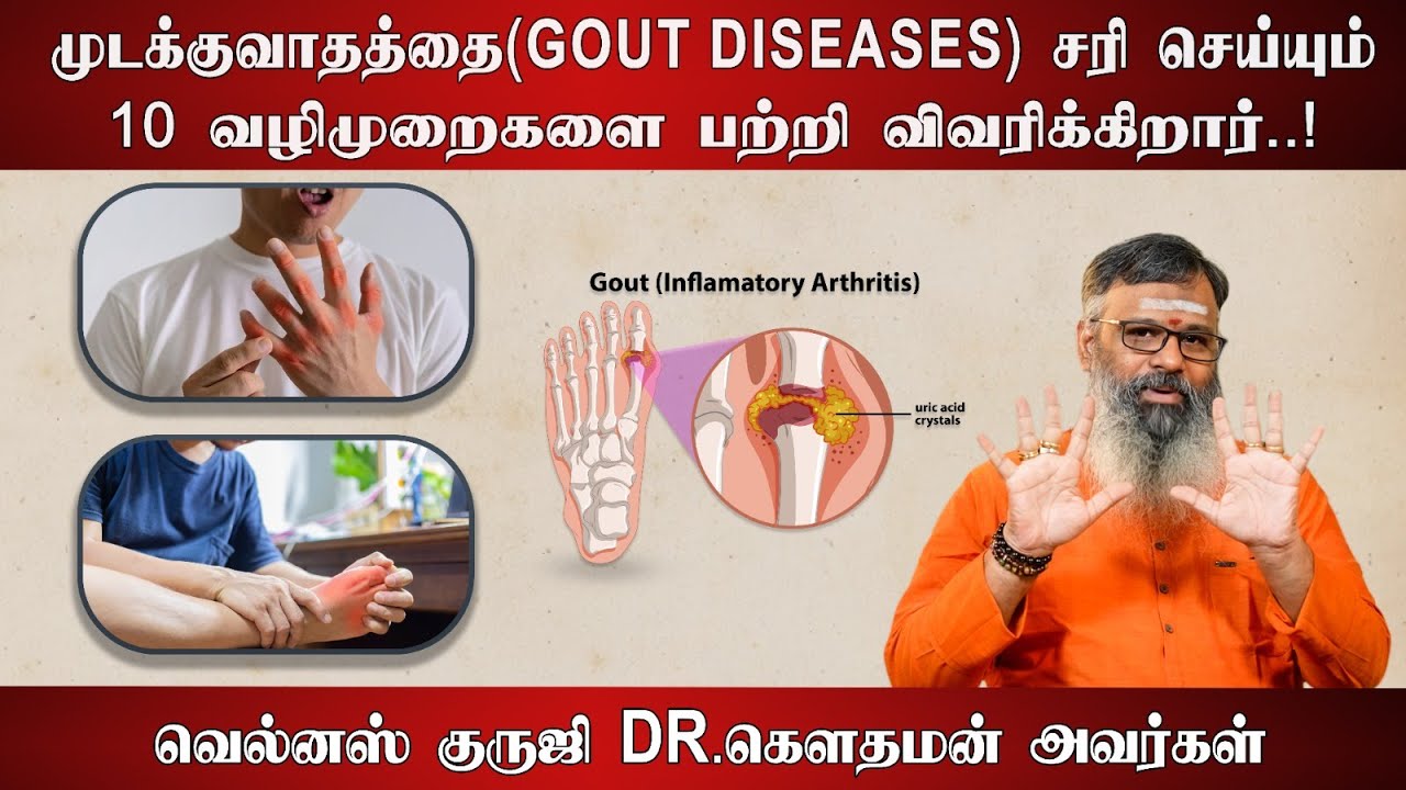 முடக்குவாதத்தை(Gout diseases ) சரி  செய்யும் 10 வழிமுறைகளை பற்றி விவரிக்கிறார் Dr.கௌதமன் அவர்கள்