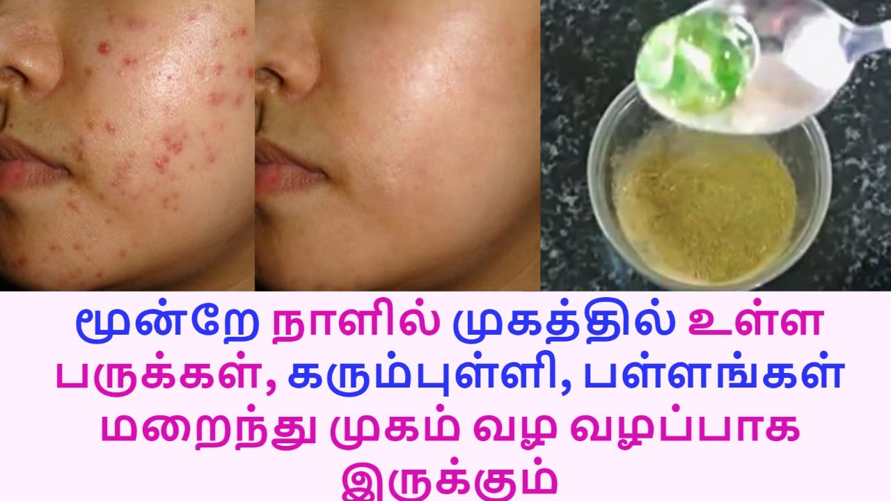 முகத்தில் கரும்புள்ளி, சுருக்கம் இருக்காது முகம் பளிச்சின்னு வெள்ளையாகிடும்