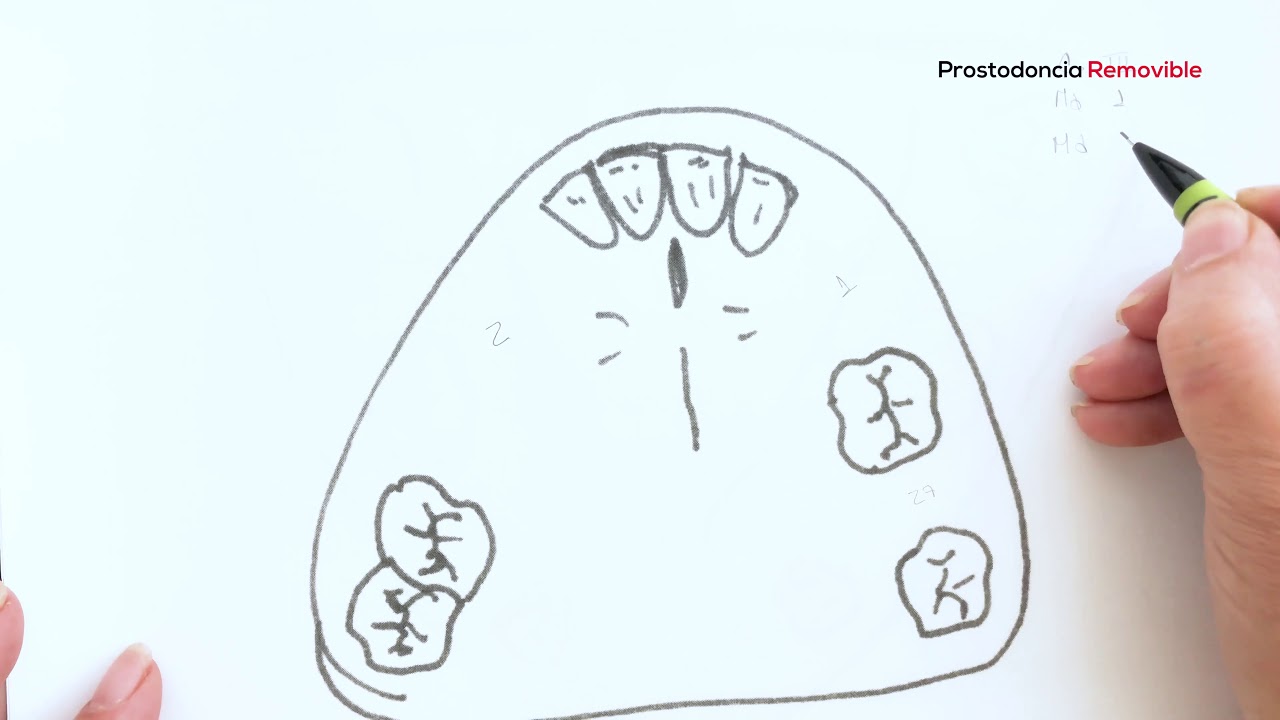 PROSTODONCIA: REGLAS DE APPLEGATE
