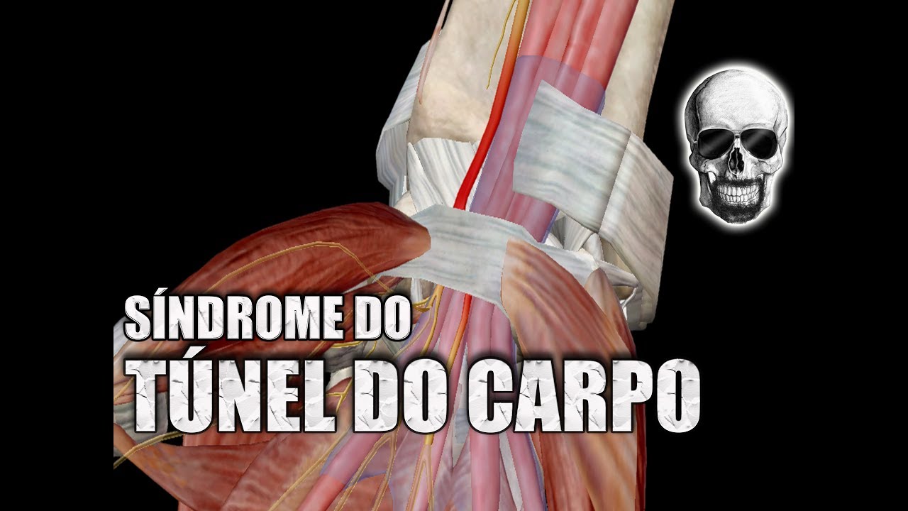 SÍNDROME do TÚNEL do CARPO e o NERVO MEDIANO | Anatomia Humana
