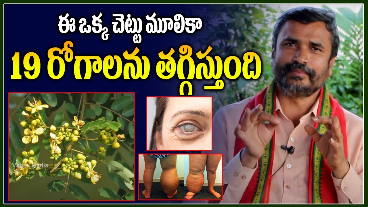 ఈ చెట్టు మూలికా 19 రోగాలను శాశ్వతంగా తగ్గిస్తుంది || Sonamukhi tree health benefits in telugu