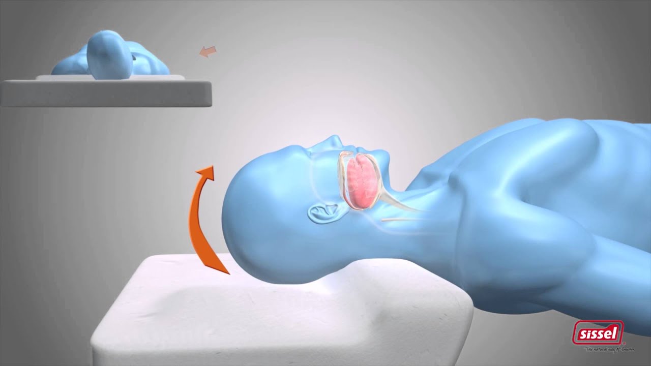 Oreiller AntiRonflement SISSEL Silencium - Réduit immédiatement le ronflement