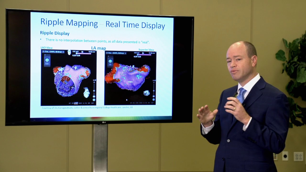 Ripple Mapping Melby