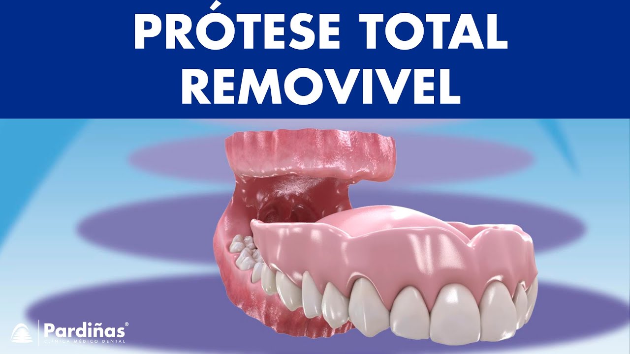PR&Oacute;TESE TOTAL REMOVIVEL ou dentadura m&oacute;vel - Informa&ccedil;&otilde;es e cuidados &copy;