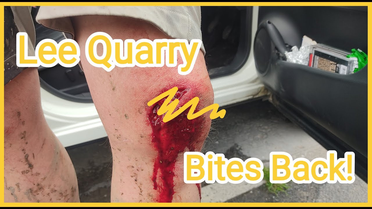 Lee Quarry Bites Back!