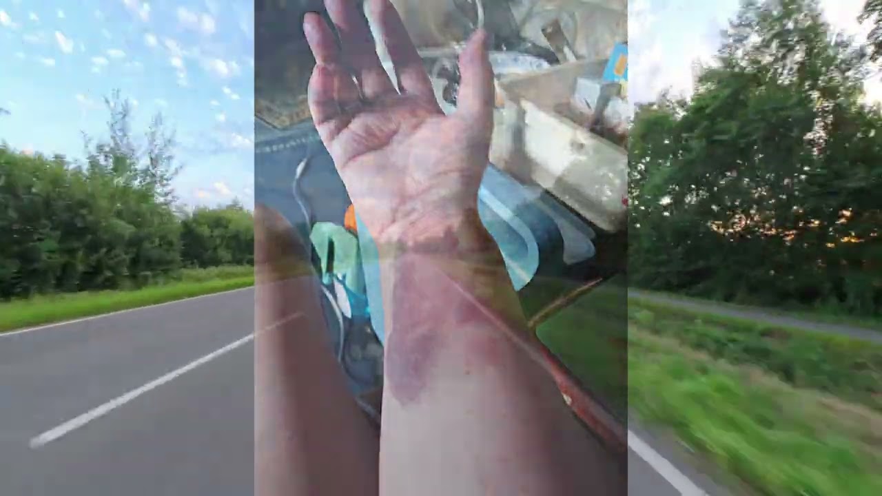 Werbung fahren nein Danke und ein blauer Unterarm 🫣🙄😒