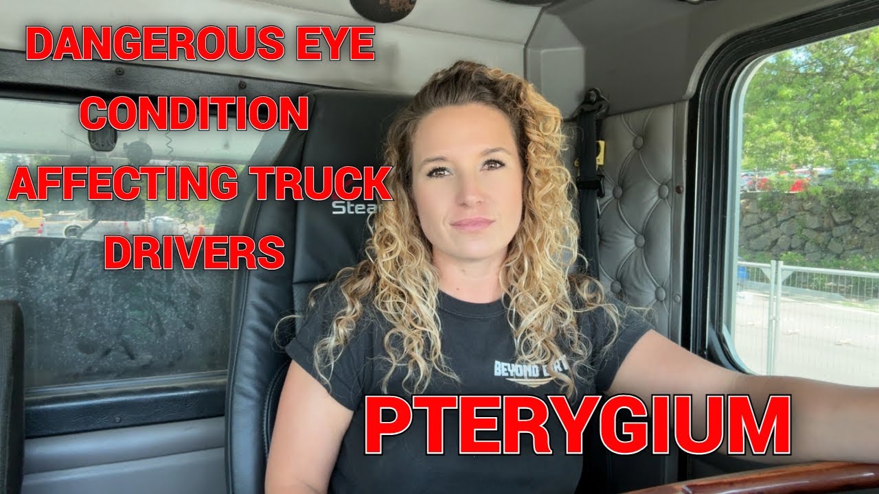 DANGEROUS EYE CONDITION AFFECTING TRUCK DRIVERS AT HIGH RATE, PTERYGIUM.