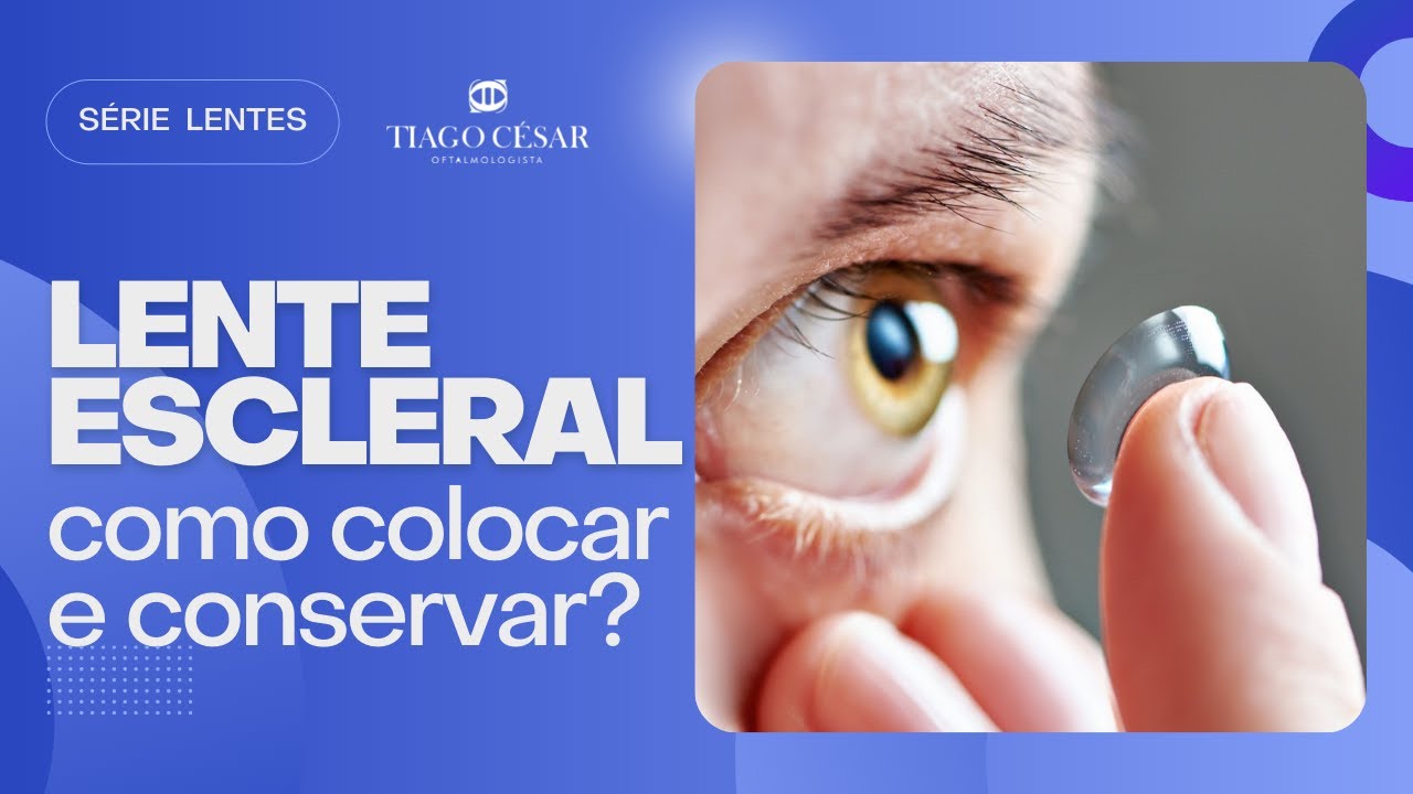 Como colocar Lente Escleral? | Conservação e Limpeza das Lentes Esclerais