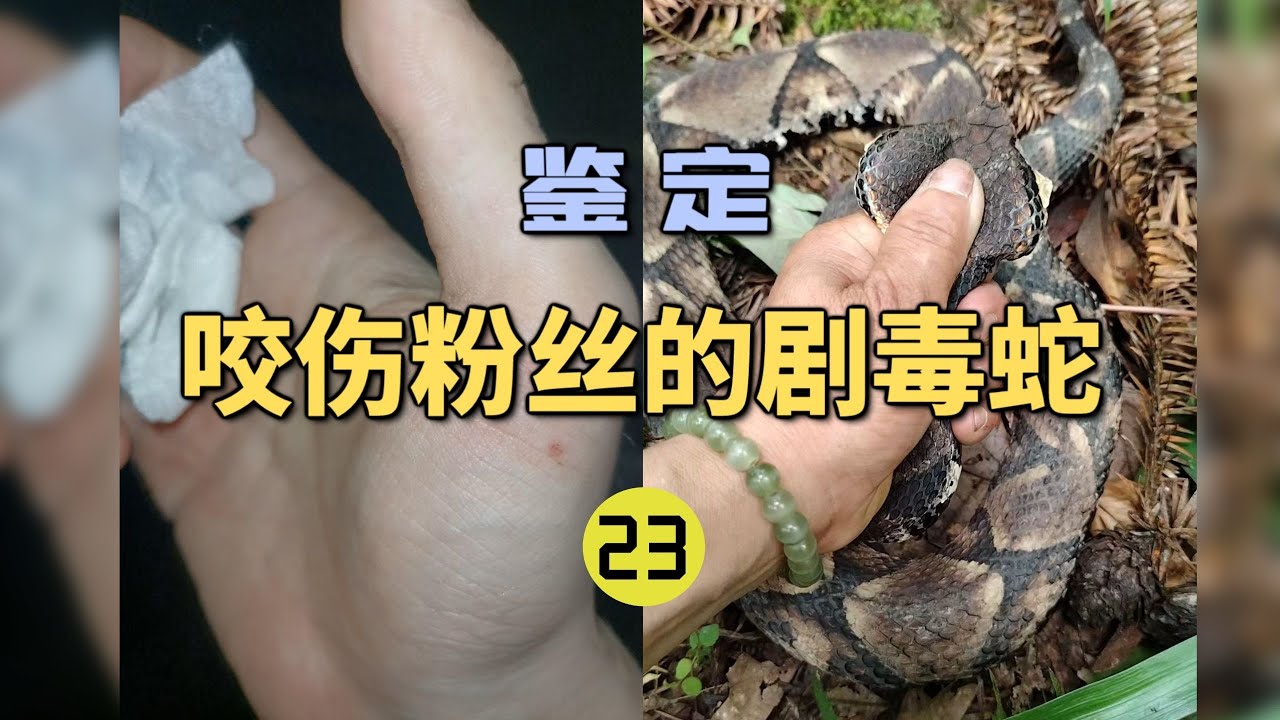4K | 鉴定咬伤粉丝的毒蛇(23) 被五步蛇咬伤竟然打了银环蛇血清？【世界记忆大师龙雅】