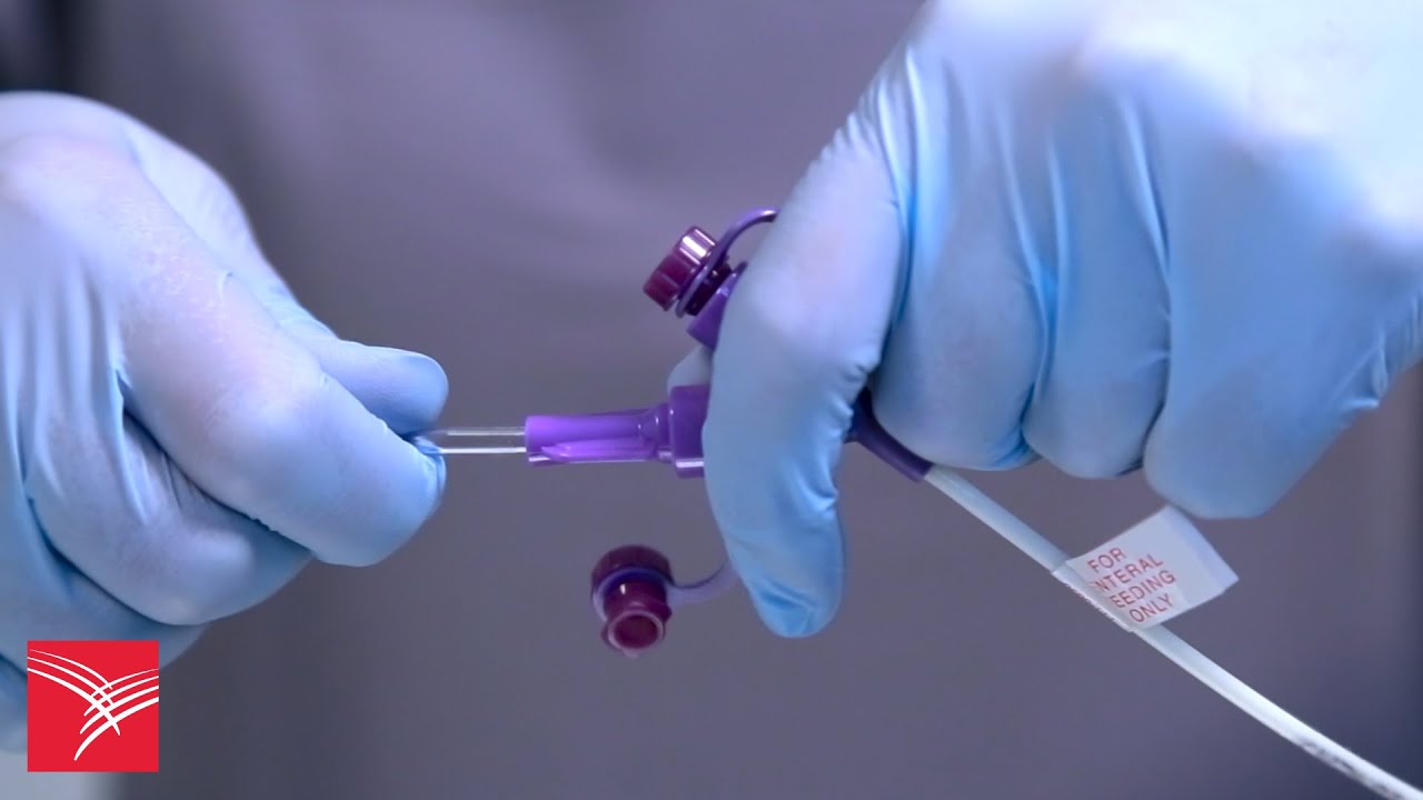 Best Practices for Connecting Kangaroo&trade; Nasogastric Feeding Tubes with Y-Ports