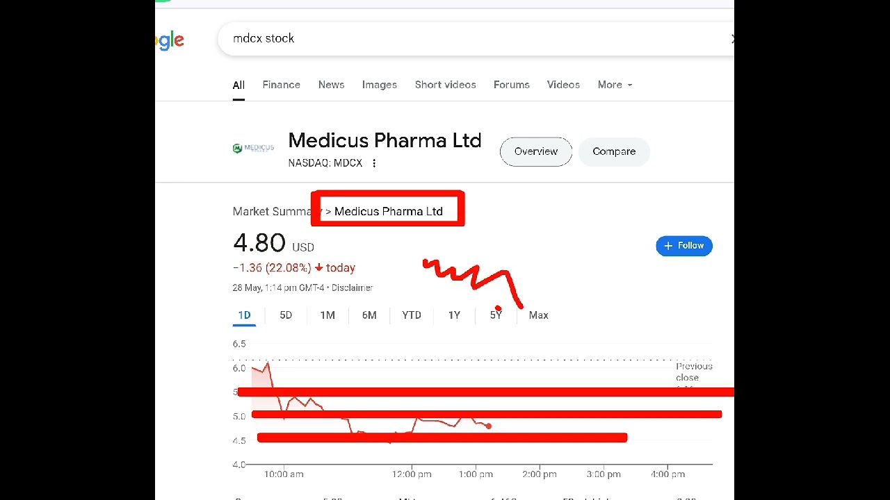 Medicus Pharma, mdcx stock analysis buy or sell