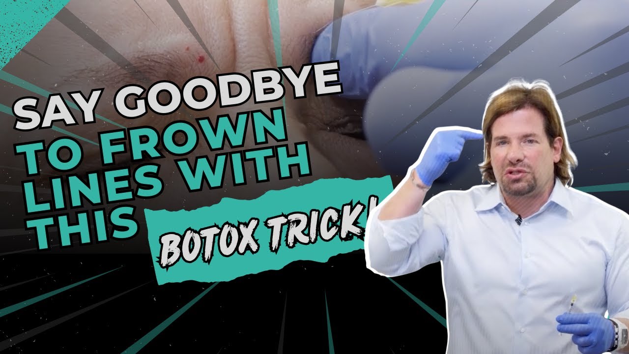 Botox Forehead Injections—The Glabellar