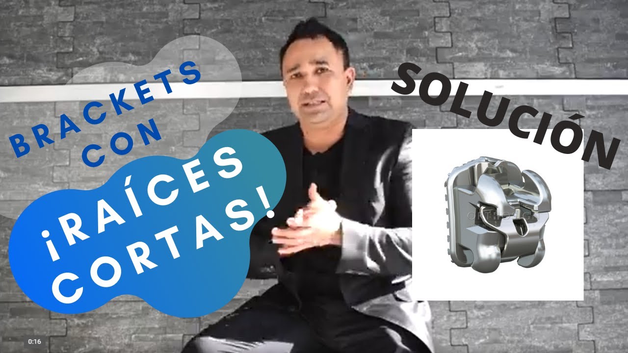 Brackets de AUTOLIGADO para RA&Iacute;CES CORTAS | Dr. Alvaro Campos