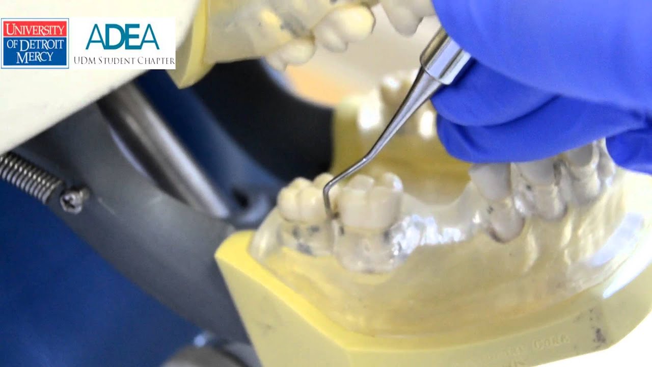 Pre-clinical Periodontal Instrumentation: Columbia 13/14