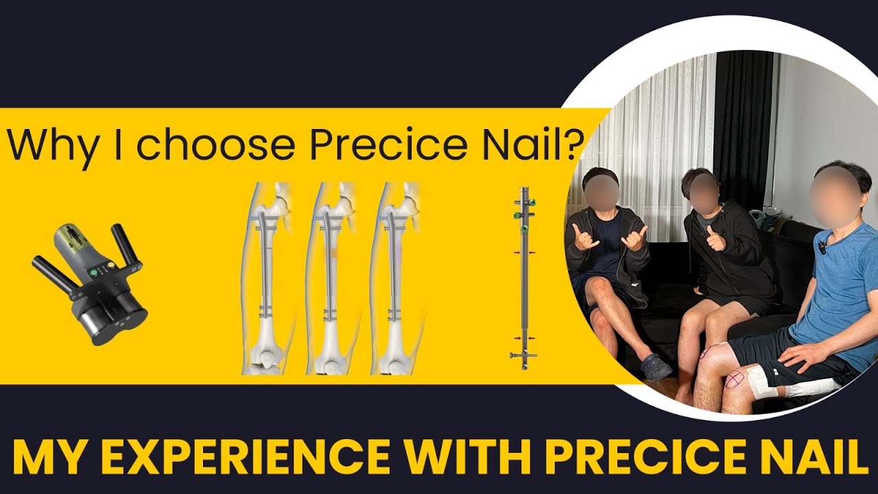 Почему я выбрал метод Precice 2? Мой опыт использования Precice Nail