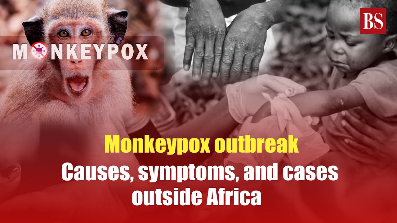 Monkeypox outbreak: Causes, symptoms, and cases outside Africa
