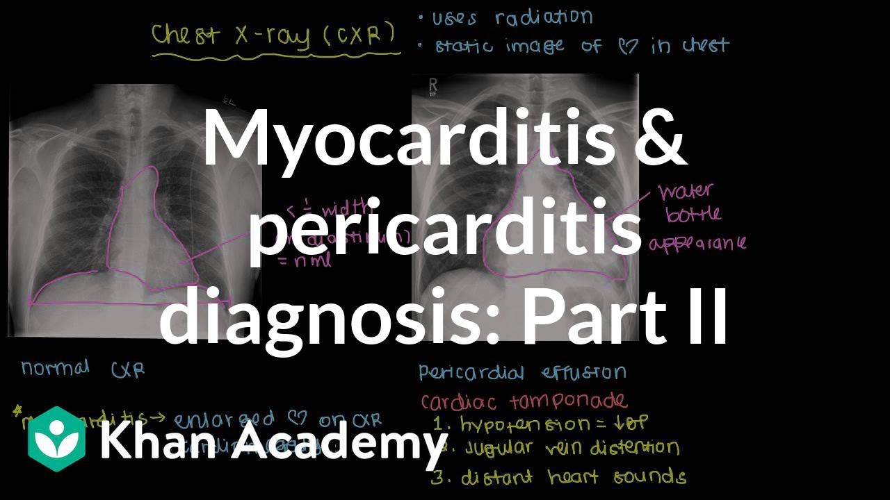 Diagnosis of myocarditis and pericarditis (part 2) | NCLEX-RN | Khan Academy