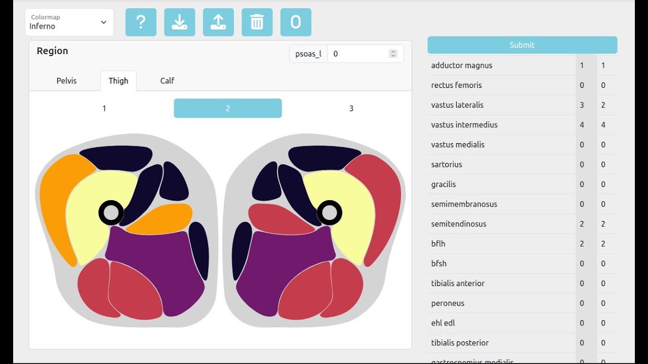 MYO-Guide | Diagnosis Tool and Web Platform | Walkthrough