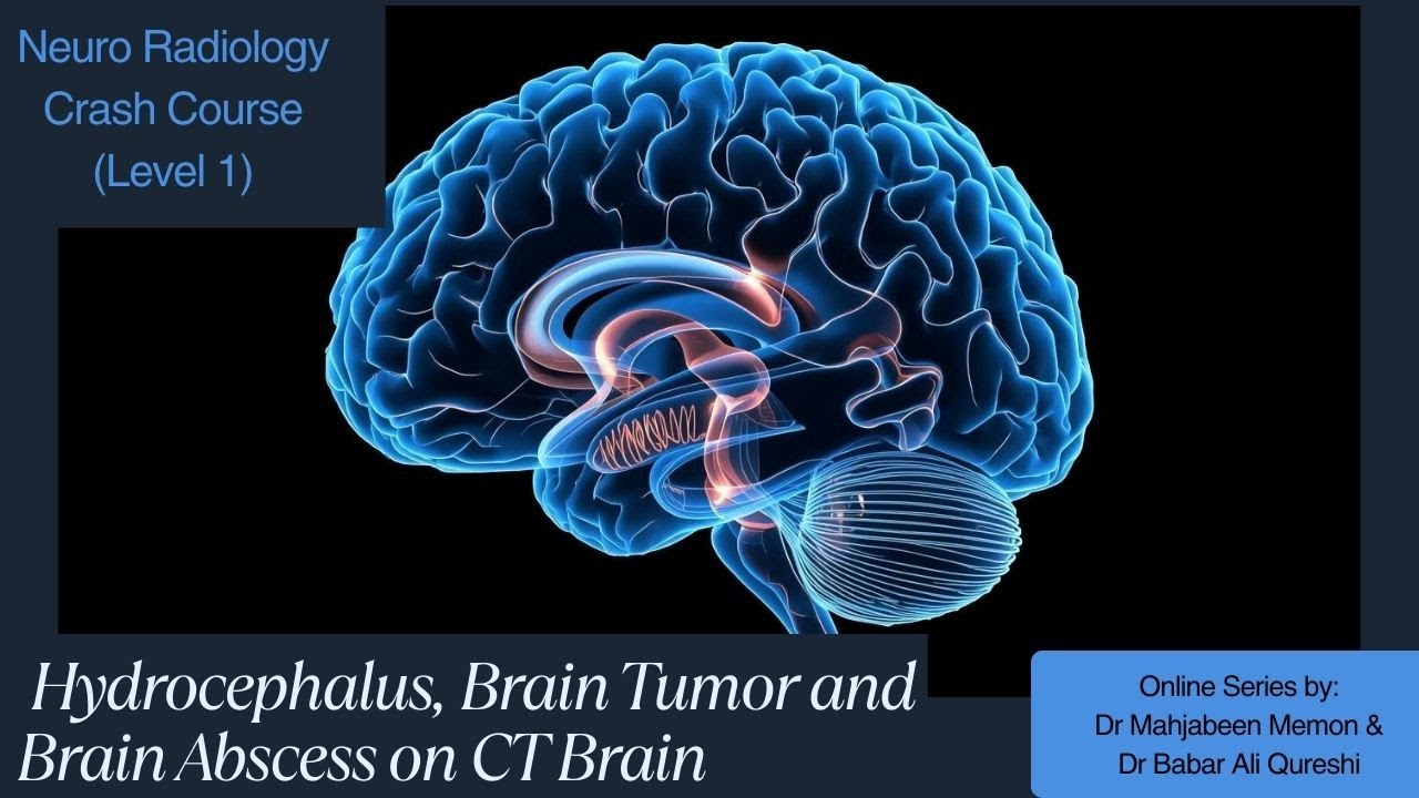 Hydrocephalus, Brain Tumors and Brain Abscess on CT Brain