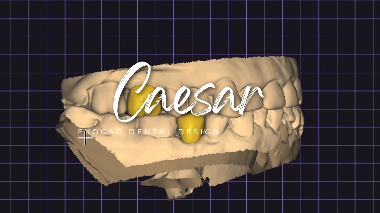 Exocad Tutorial: Molar & Premolar Tooth Design Step by Step!