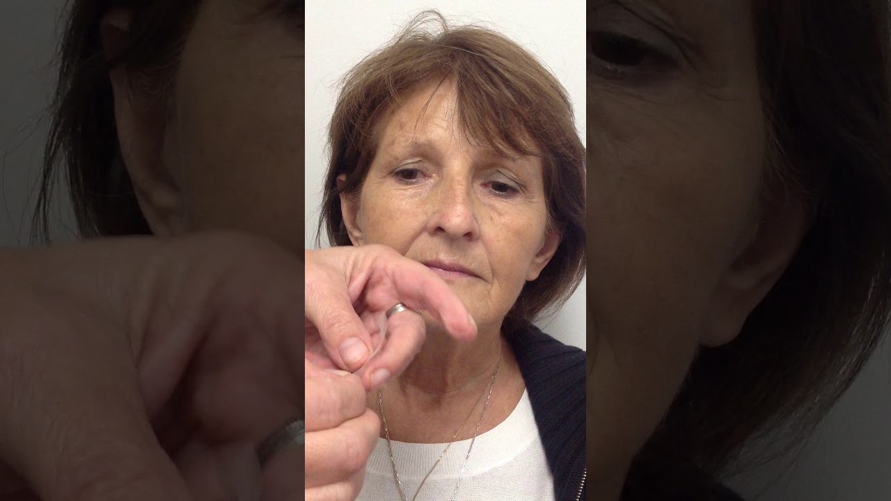 Eye taping technique for facial palsy