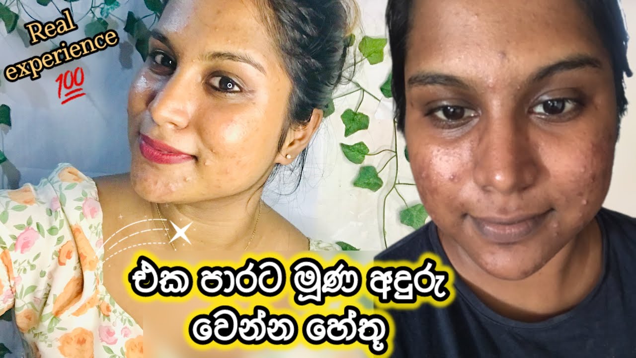 සම අඳුරු වීමට සැබෑ හේතු මෙන්න! 🕵️‍♀️ The Secret Behind Face Darkness | මගේ අත්දැකීම් එක්ක 💯| #vlog
