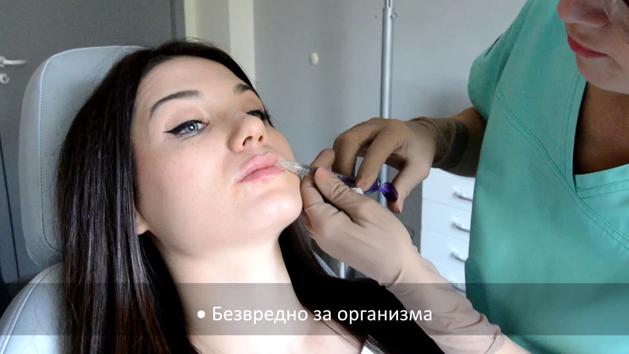 Оформяне на устни с хиалуронова киселина - д-р Катя Паскова
