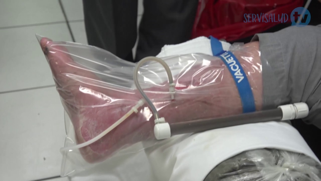 Servisalud TV  - Edición 9 - Ozonoterapia