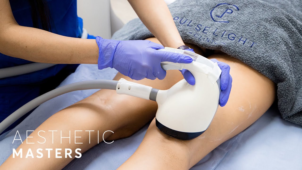 Cellulite Removal Treatment