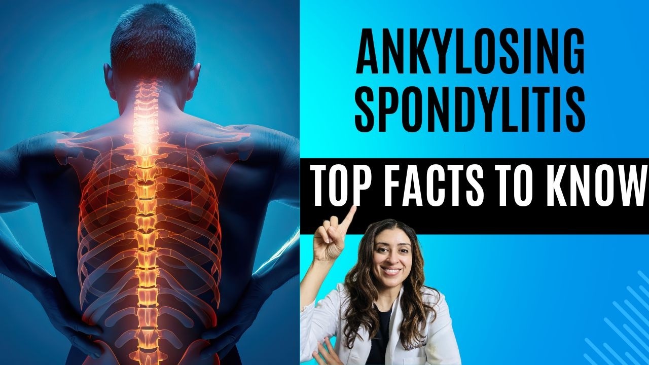 Ankylosing Spondylitis updates in diet, the gut microbiome, exercise and more