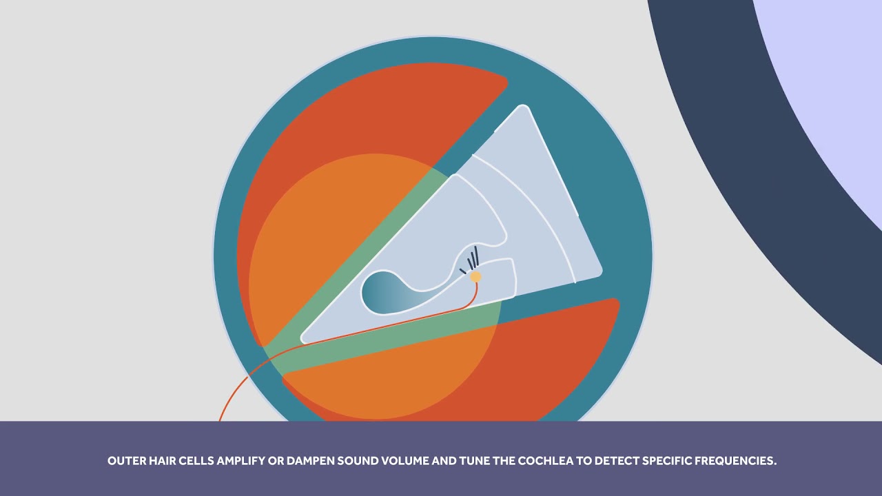 Lost Sensory Hair Cells and Hearing