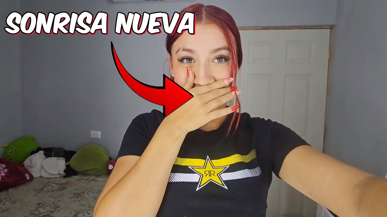 ¡POR FIN ME QUITAN LOS BRAKETS!😱 Miren la nueva sonrrisa de SARKA🥺🥰