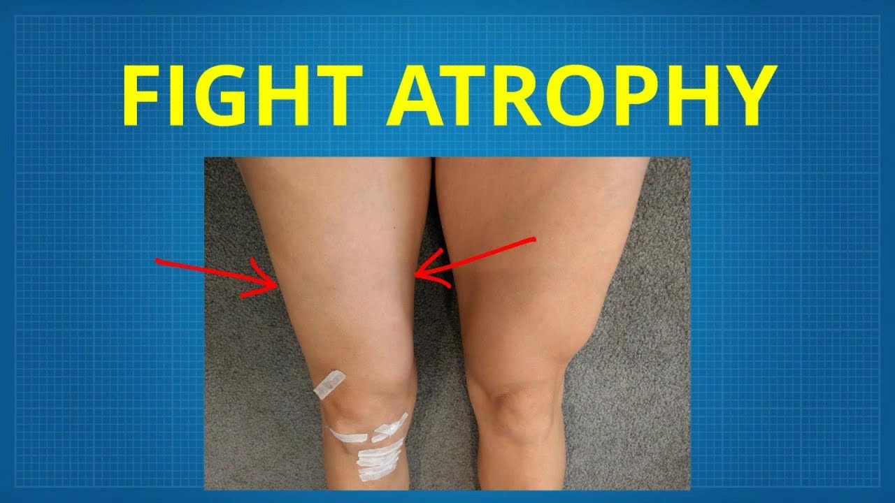 BFR to prevent atrophy from broken leg inc soundtrack