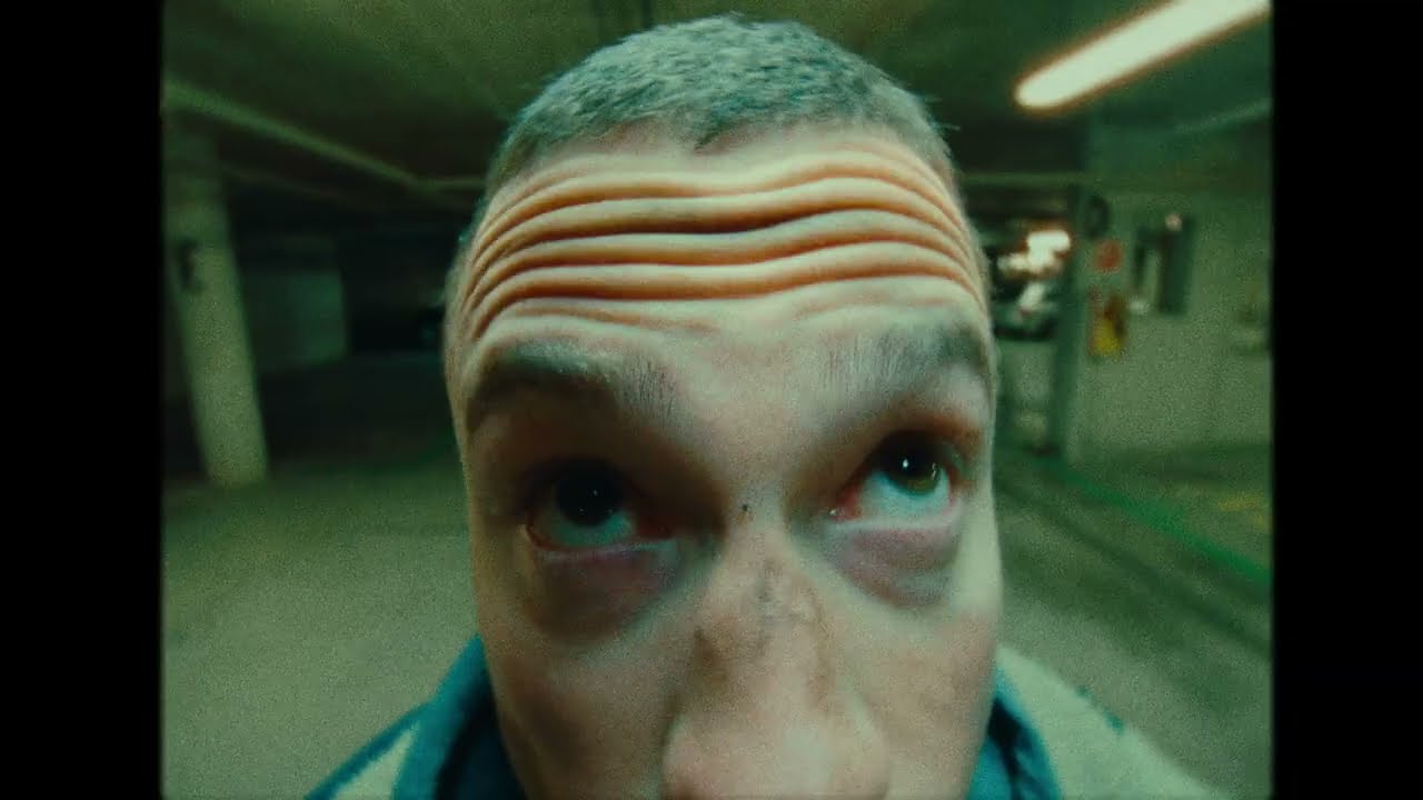 Albert- Amore Tossico